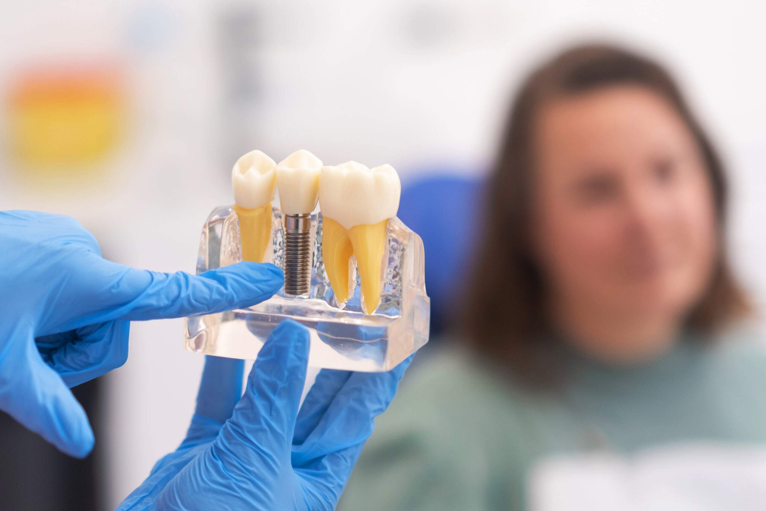 ¿Duele ponerse un implante dental? Todo lo que debes saber sobre el procedimiento