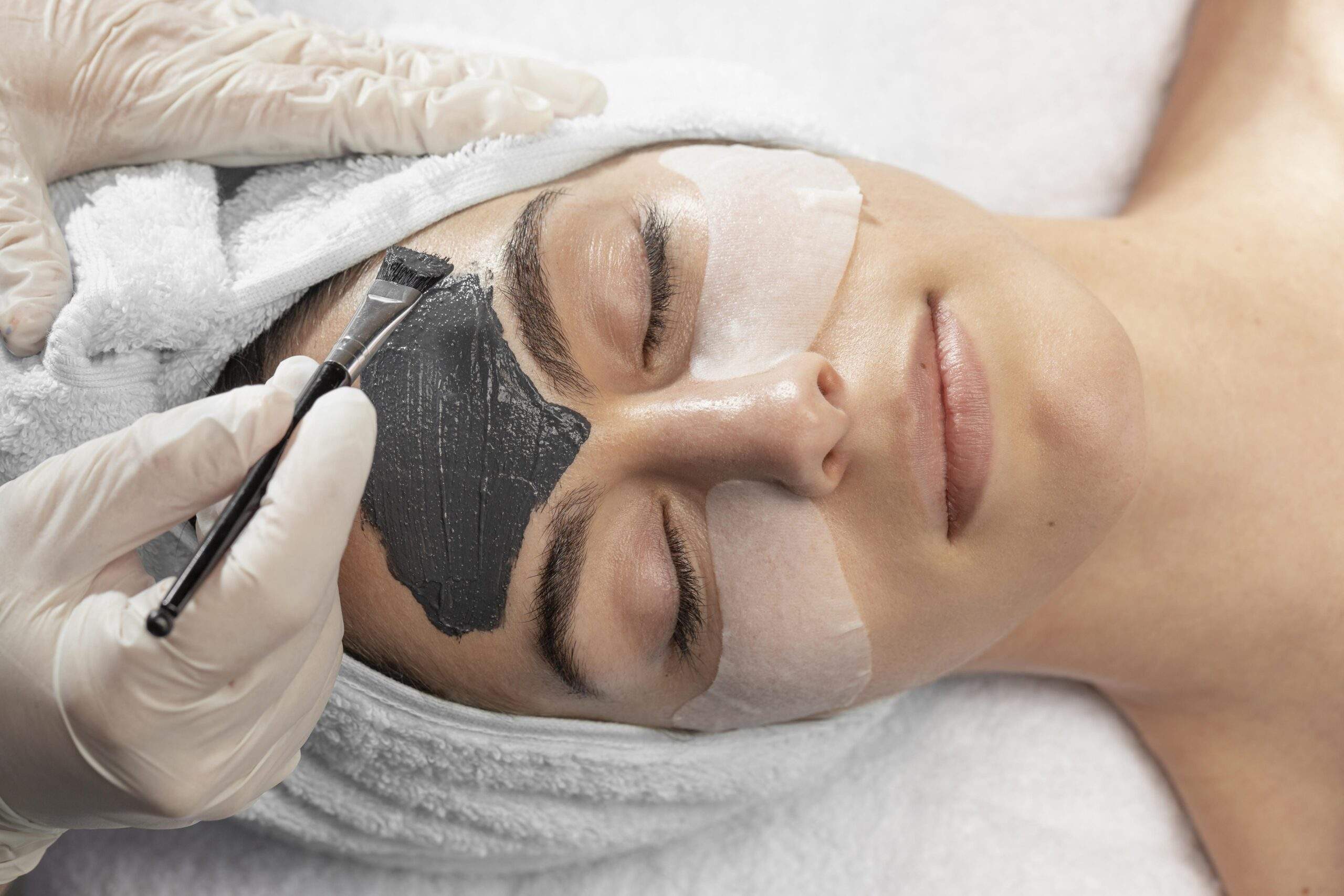Hollywood peel