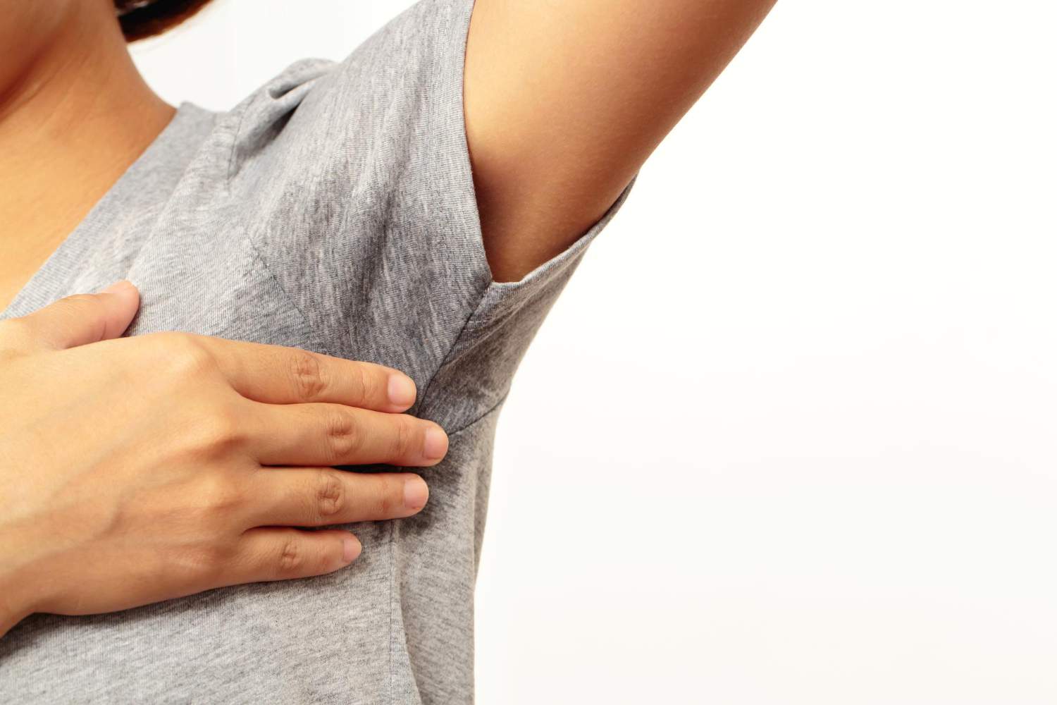 HIPERHIDROSIS EN AXILAS