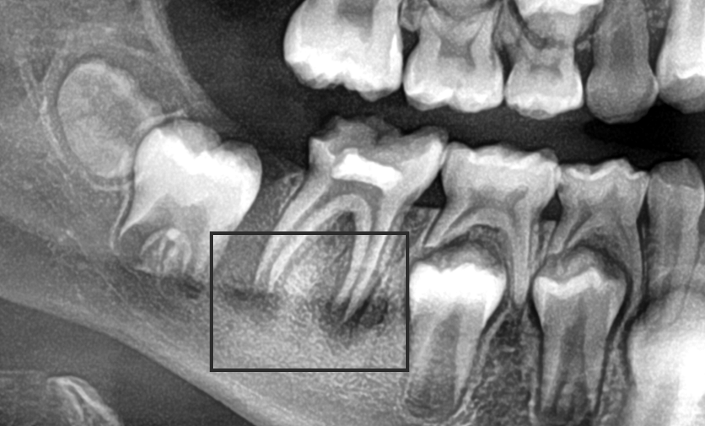apicoformacion